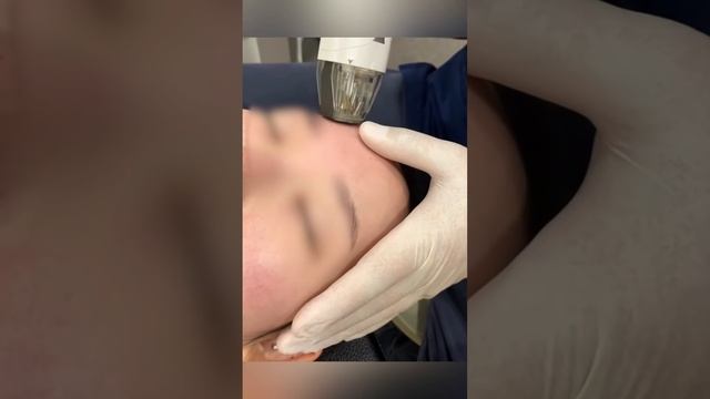 Запишись на консультацию ➡️ https://www.365plastics.co.kr #сеул #пластикавкорее #лечениевкорее смотреть онлайн