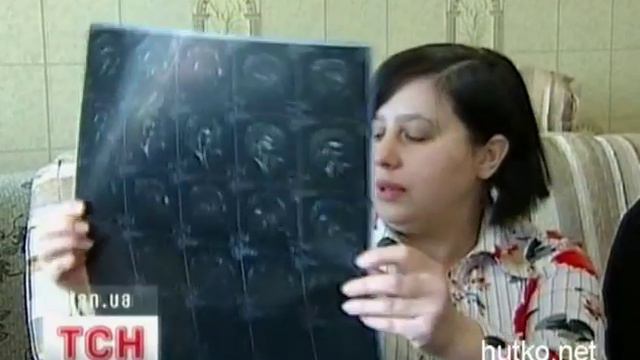 U rebenka takoi diagnoz, chto daje vrachi ne znayut kak lechit' смотреть онлайн