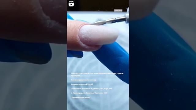 Проработка синуса и боковой пазухи фрезой пламя смотреть онлайн