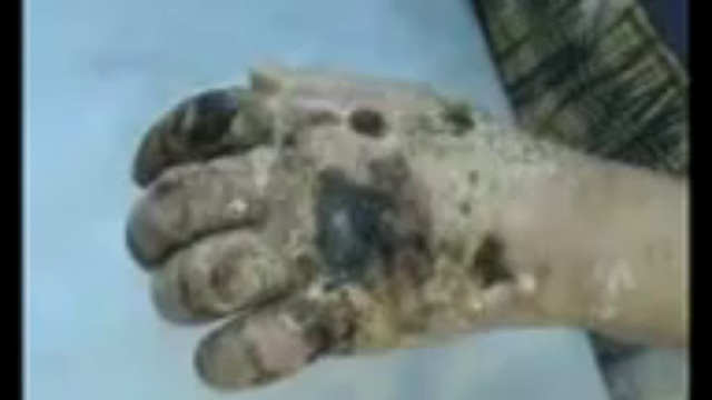 Последствия приёма коаксила