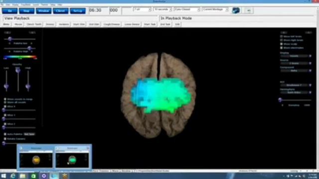 Про Access bars рассказывает и показывает исследования, доктор психологии,невролог Джеффри Феннин смотреть онлайн