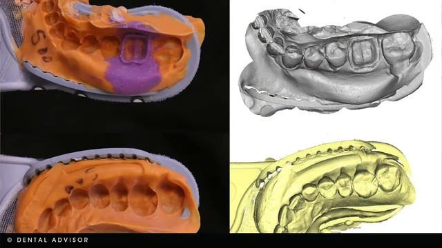 From the Field - Dental Milling: Does the Type of Impression Material Matter? смотреть онлайн