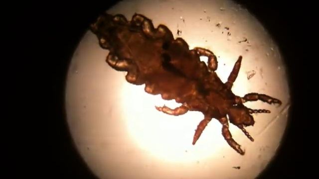 ВШИ HEAD LICE смотреть онлайн