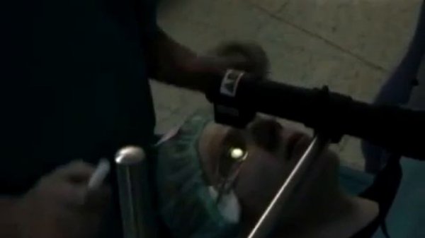 Кератоконус и корнеальный кросслинкинг CCL