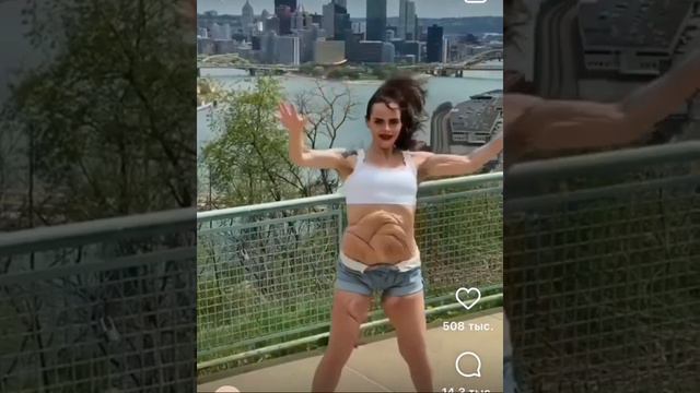 Кожа висит после похудения 😱 смотреть онлайн
