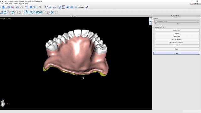 Step 4 Creating and Festooning the Gingival Base in the Blue Sky Plan Denture Module v 4 7 15 смотреть онлайн