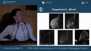 МРТ в диагностике рака молочной железы