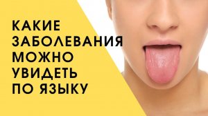 Диагностика по языку | Почему на языке появилась болячка