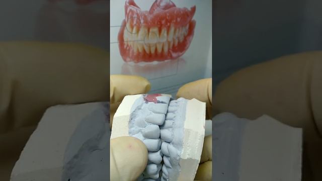 Нейлоновый микропротез смотреть онлайн