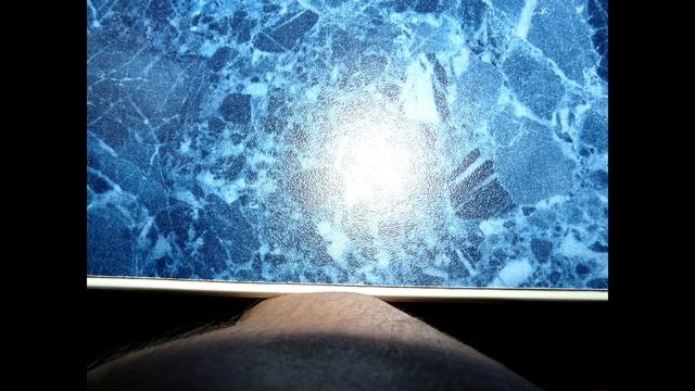 Шелушится локоть что делать смотреть онлайн