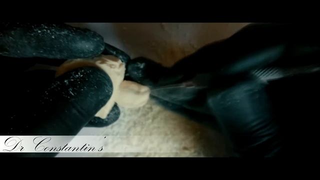 Коронкова частина зуба з мила.[ 3D ANATOMY TOOTH ]