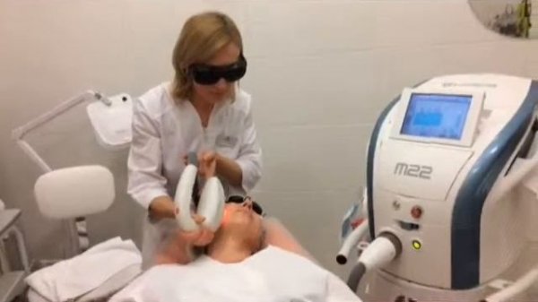 Фотоомоложение на аппарате M22