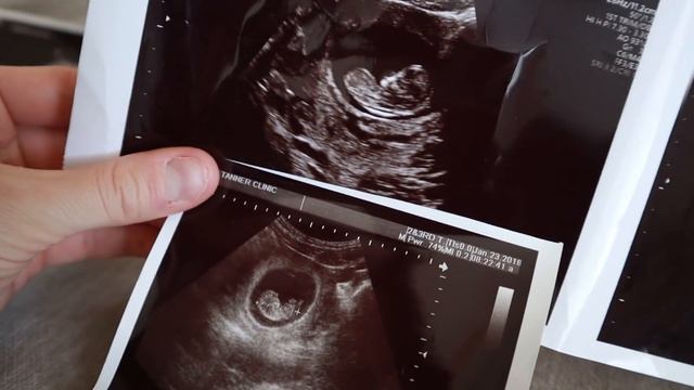 Comparing Our Babies Ultrasounds! смотреть онлайн