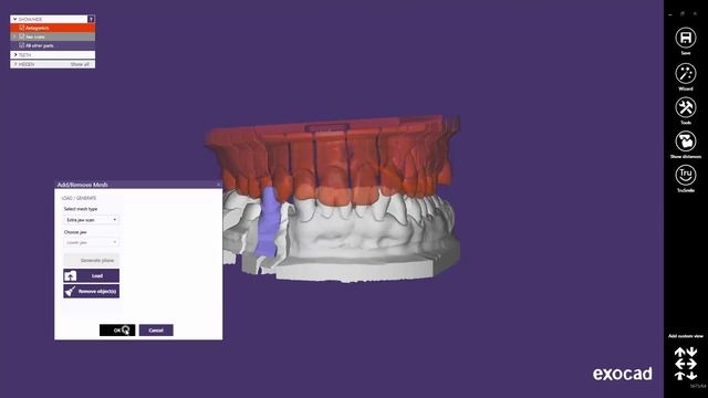 exocad Quick Guide: Extra Jaw Scan смотреть онлайн