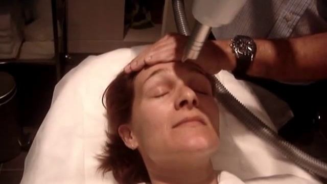 Non-Ablative Skin Rejuvenation using Fractional Erbium YAG Laser : ProFrax-2940.wmv смотреть онлайн