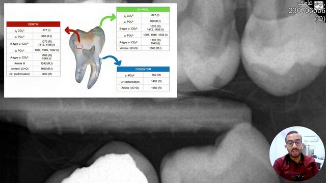 How to Manage upper7 with deep distal caries || Dr. Ahmed Ashraf смотреть онлайн