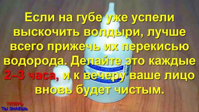 ГЕРПЕС || 7 Народных МЕТОДОВ, Которые ПОМОГУТ Тебе ИЗБАВИТЬСЯ От ГЕРПЕСА В Течение ДНЯ! [ВАЖНО] смотреть онлайн