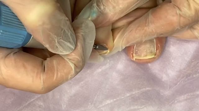 Аппаратный педикюр ? педикюр на себе смотреть онлайн