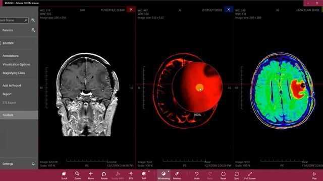 Athena DICOM Viewer смотреть онлайн