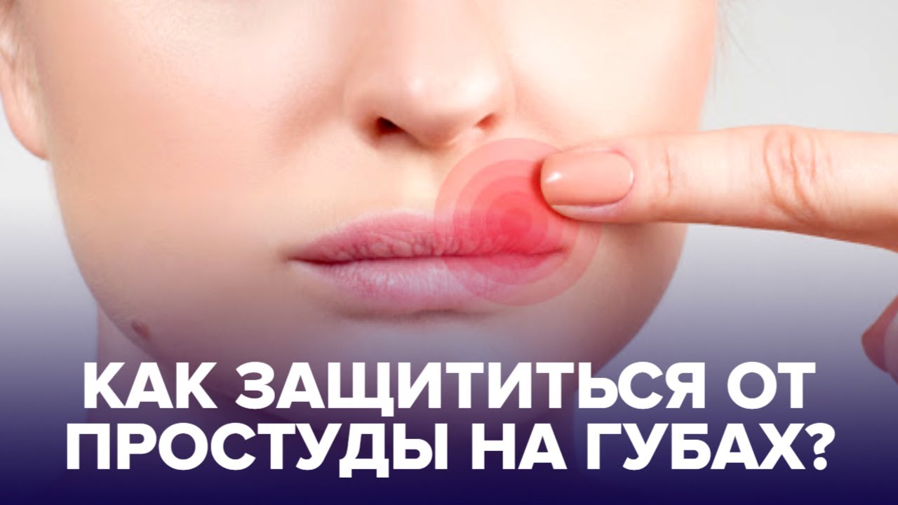 ГЕРПЕС на губах: почему ацикловир не помогает и можно ли вылечиться навсегда?