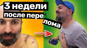 Восстановление после перелома ключицы: Таш снова бегает | Межпозвоночная грыжа