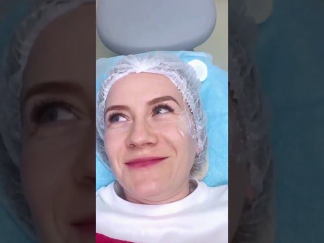 Radiesse 10