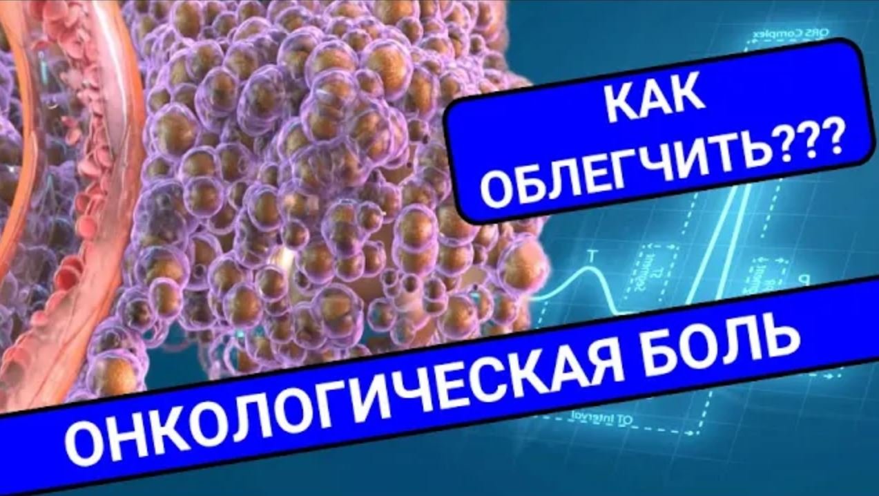 КАК УМЕНЬШИТЬ БОЛЬ ПРИ ОНКОЛОГИИ? смотреть онлайн