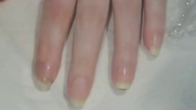 Как отрем поломанный ноготь используя чайн пакетик смотреть онлайн