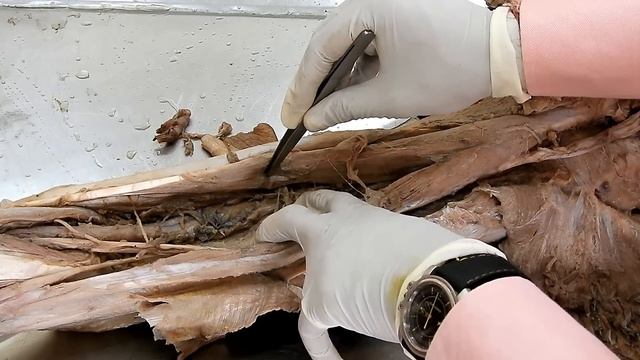 Revision of Lower Limb смотреть онлайн