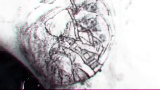Скарификация собственного тела! (Created with @Magisto) смотреть онлайн