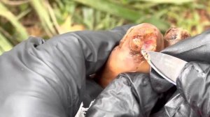 Jigger digging Thomas Matende - WHOLE JIGGERS PULLED OUT - see full video @riseupsociety.net