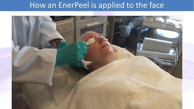 What is an Enerpeel? смотреть онлайн