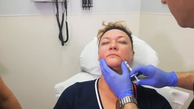 Bio-enhanced Growth Factor therapy in Hair By Dr. Max, Fort Lauderdale, Florida. Как это работает? смотреть онлайн