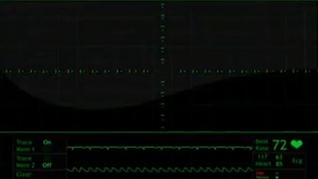 heart beat monitor animation free stock footage смотреть онлайн