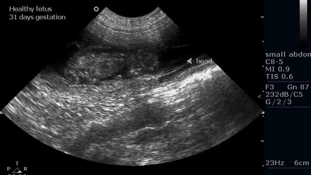 Spenser Ultrasound 1 смотреть онлайн