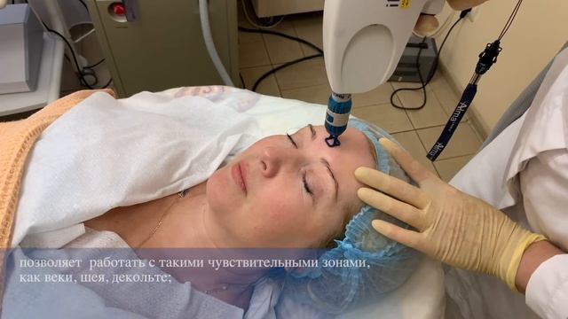Косметология лазерный пилинг смотреть онлайн