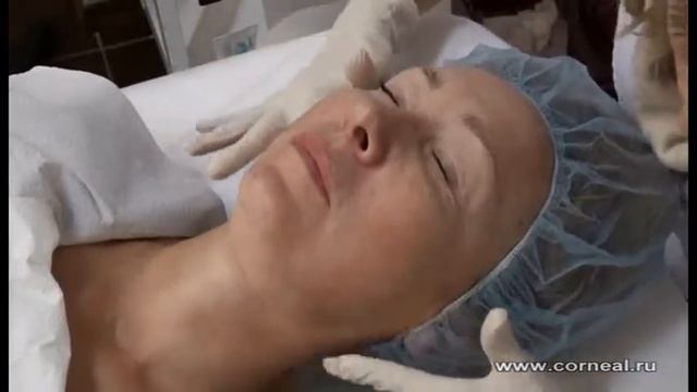 Легкое пощипывание от пилинга Джесснера смотреть онлайн