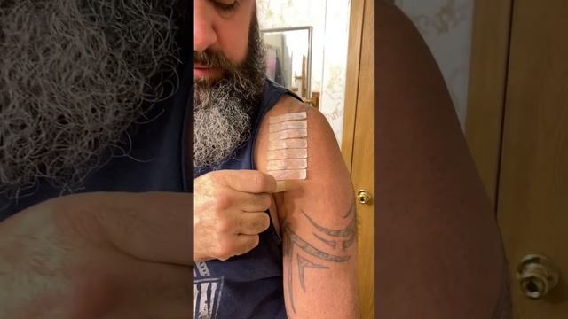 Full Shoulder Replacement Scar Reveal смотреть онлайн