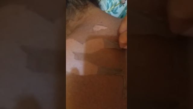 #oddly_satisfying Peeling off my sun burnt skin смотреть онлайн