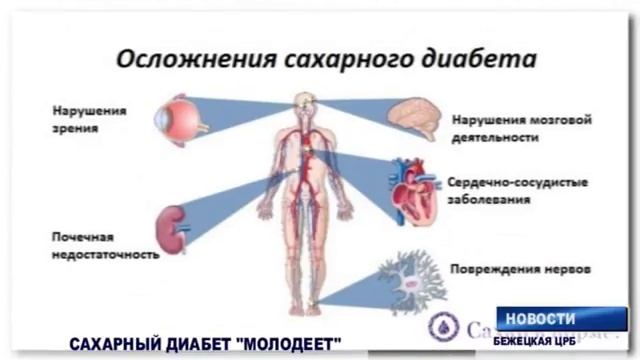 Берегите свое здоровье смотреть онлайн