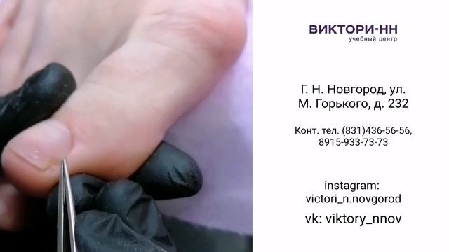 Модуль-курс: «Введение в подологию. Заболевания и деформации ногтей»