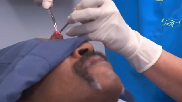 Top 3 Most Viewed Dr Pimple Popper Videos In 2021 | Dr. Pimple Popper