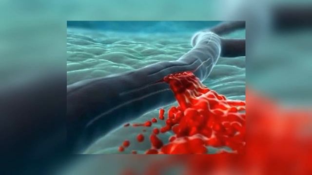 Генные заболеваний, Гемофилия и Синдром Дауна (Презентация по биологии) смотреть онлайн