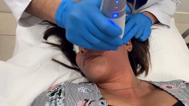 Skin rejuvenation using the Clear + Brilliant laser treatment by Dr. Shaun Patel. смотреть онлайн