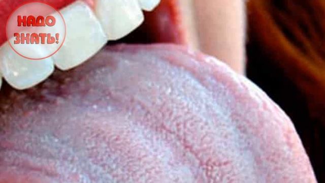 Почему возникает горечь во рту? Главные причины! смотреть онлайн