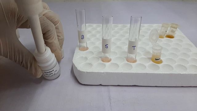 CHOLESTEROL Test Procedure | CHOLESTEROL Reagent | Procedure for performing CHOLESTEROL Reagent Tes смотреть онлайн