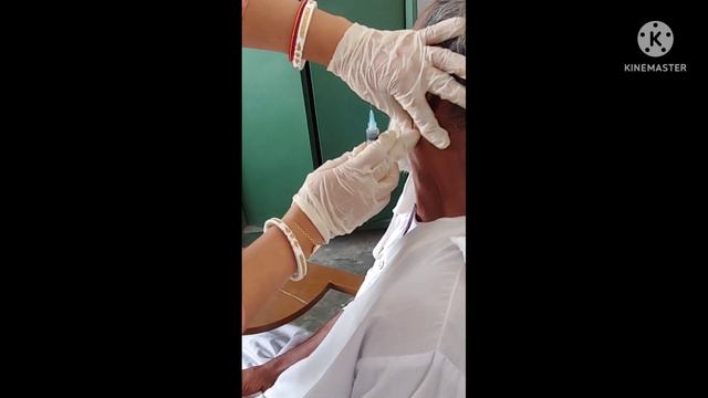 Fine needle Aspiration Cytology of Posterior Cervical Lymph Nodes Maligancy।। смотреть онлайн