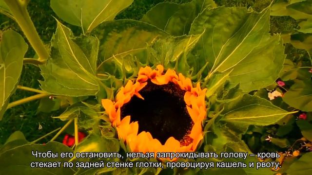 Запасайтесь зеленкой и йодом смотреть онлайн