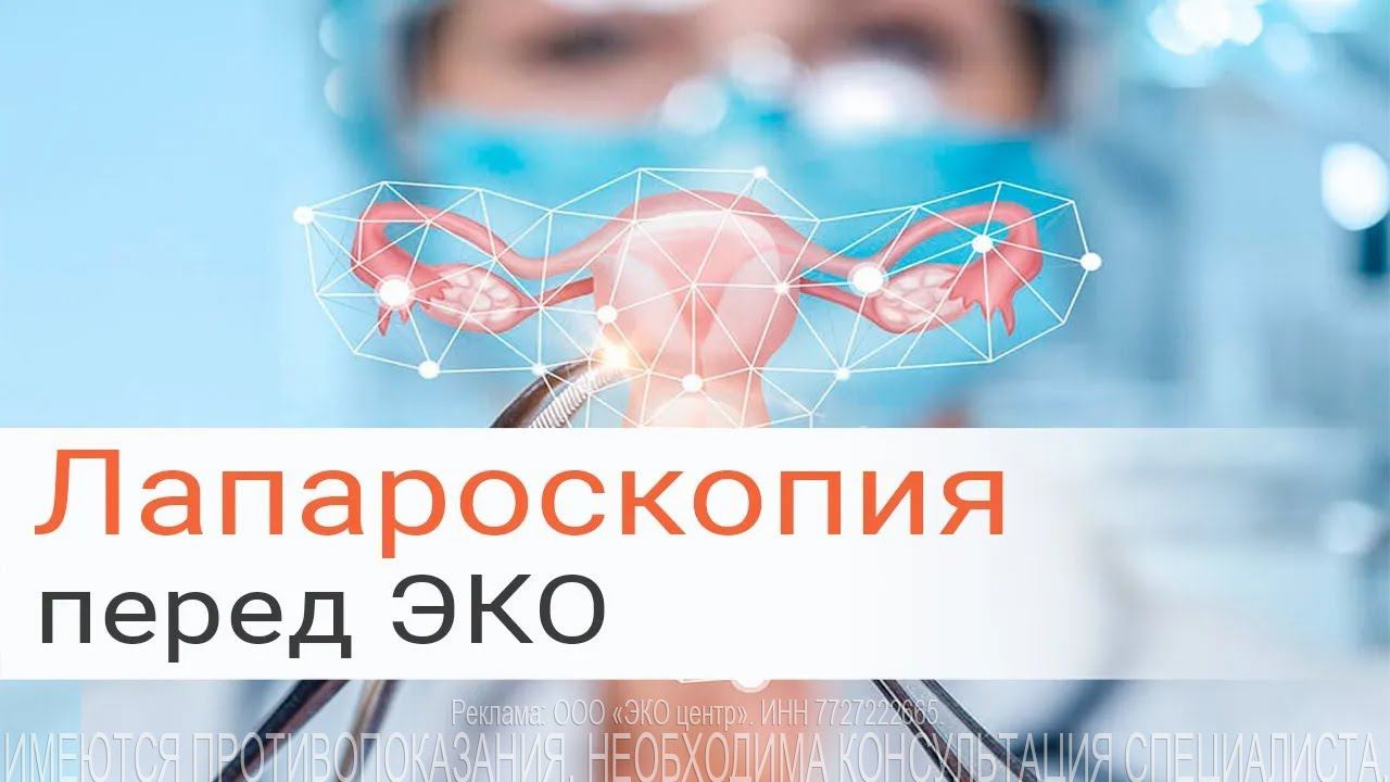 Лапароскопия в гинекологии и перед ЭКО смотреть онлайн