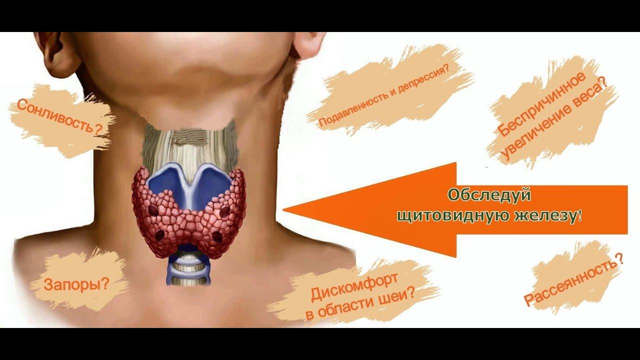 Диагностика щитовидной железы смотреть онлайн